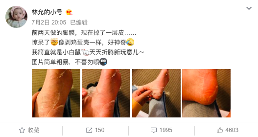 林允回应公开撕脚皮 明星都这么没偶像包袱了吗?
