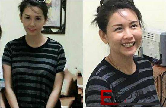 邱淑贞看病被偶遇 脸蛋很美身材略有发福!
