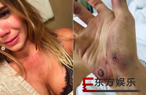 名模女星遭家暴 揭秘娱乐圈和家暴相关的明星有哪些!