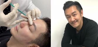 陈浩民承认整容 别人都做我不做很吃亏!