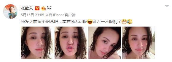 张歆艺晒素颜美照 脱发实在脱无可脱!
