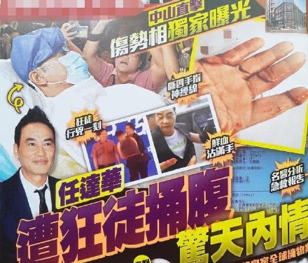 任达华3厘米刀伤 任达华遇刺事件后续!