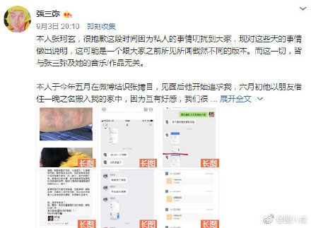 明日之子张嫮目疑家暴 将女方手指无故掰断?