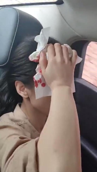黄圣依拍戏时头部受伤 血流不止吓坏粉丝