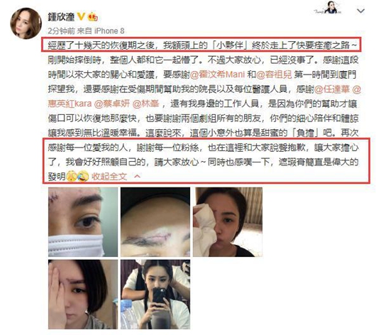 阿娇伤口照曝光 缝合针线明显有些骇人!
