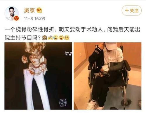 吴京曝谢楠桡骨粉碎性骨折 责备老婆想手术完就想去主持